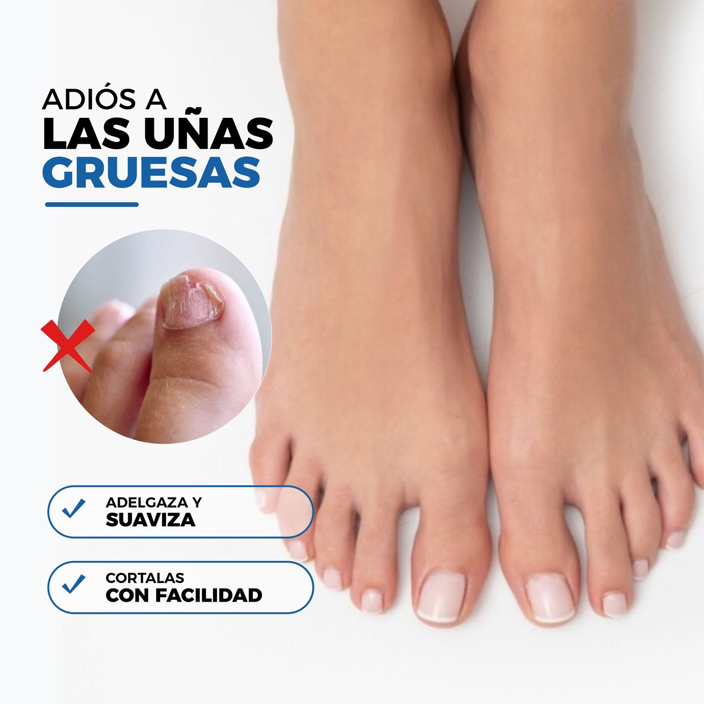 Parches AntiHongos y Regeneradores De Uñas - NailPatch®